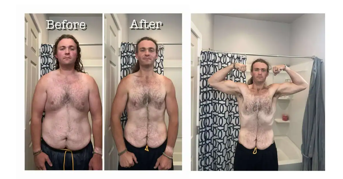 Sterling Hofman after 42 Day fasting