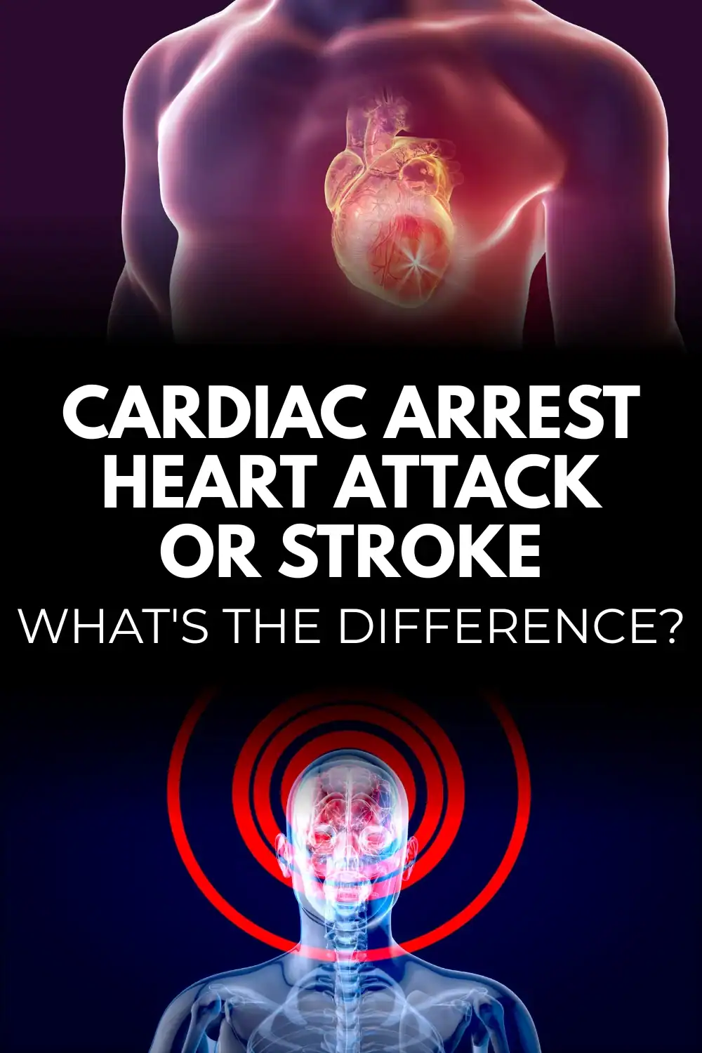 Cardiac arrest, heart attack or stroke... What's the difference?