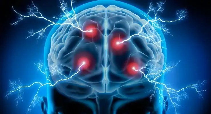 Illustration of a human brain glowing blue with red hotspots and lightning bolts, symbolizing neural activity or pain, on a dark background.