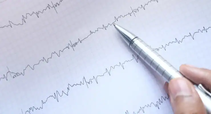A hand holding a pen over an electrocardiogram (ECG) paper with multiple wavy line readings.