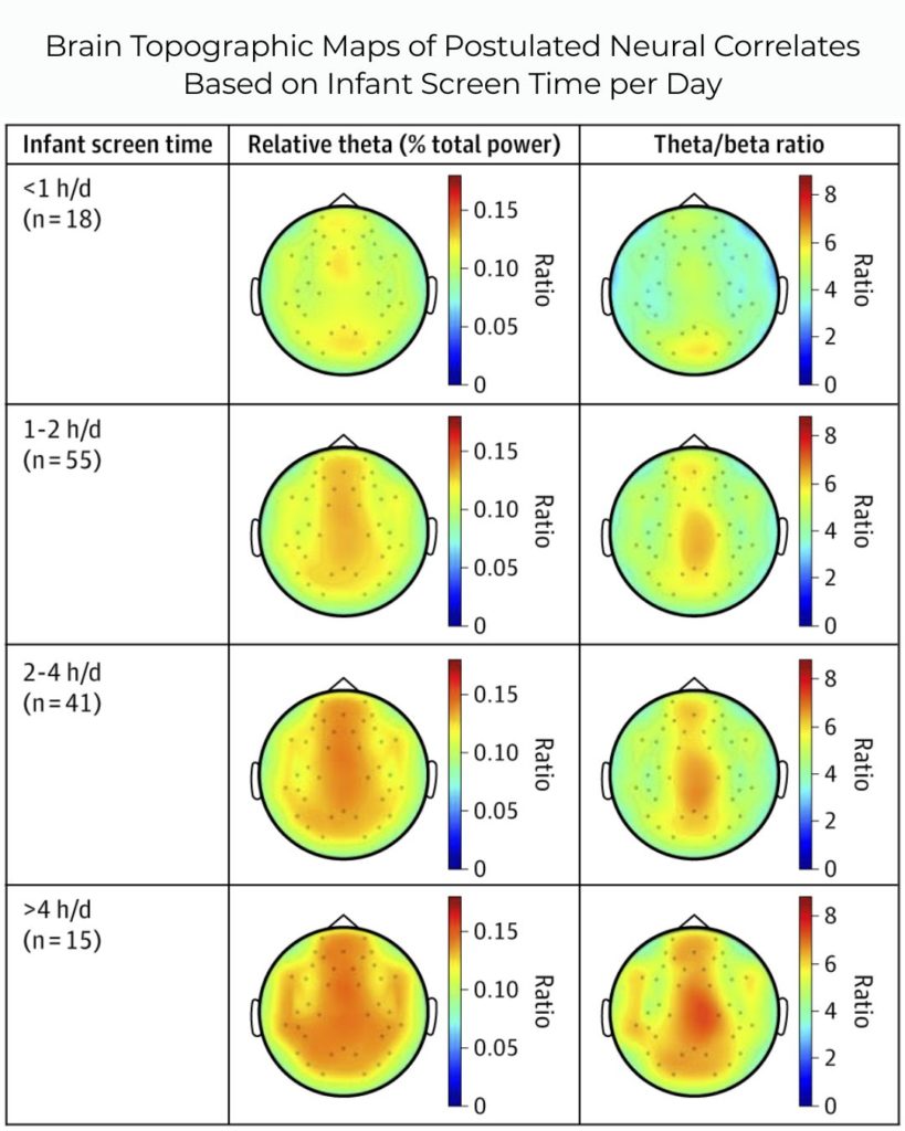 Brain Topographic Maps of Postulated Neural Correlates Based on Infant Screen Time per Day